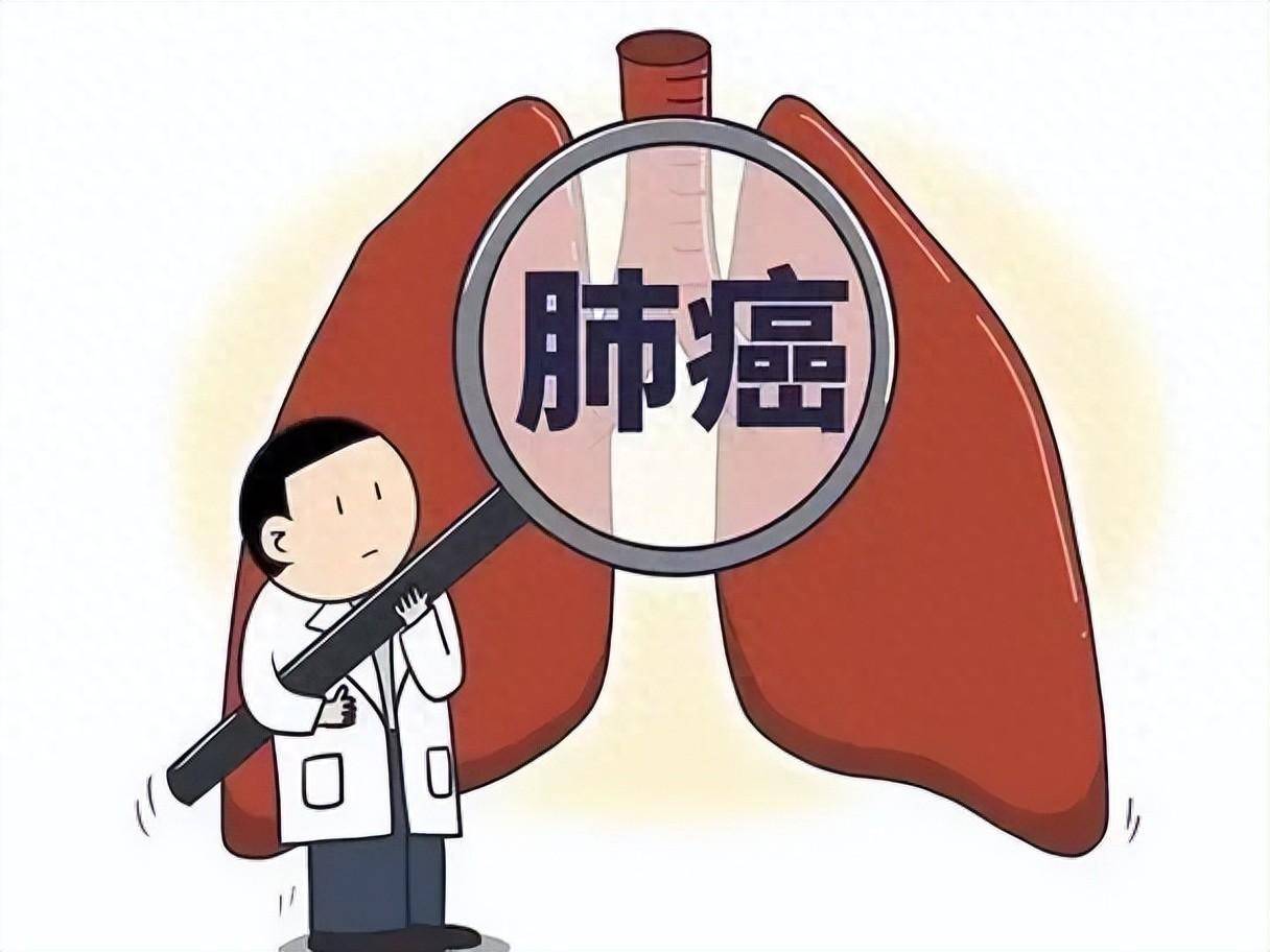 5大症状预示早期肺癌 预示早期肺癌的症状