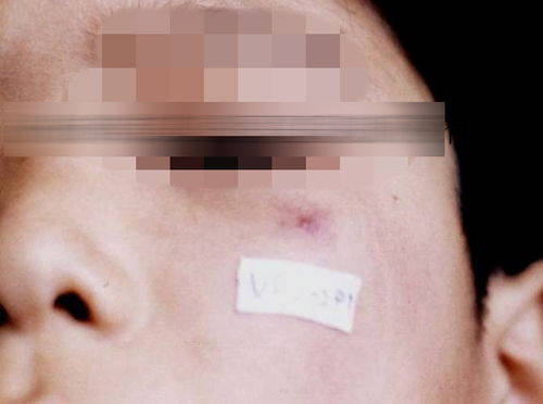 �վ���֢���� �վ���������ͼƬ