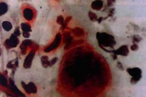 �����������ǲ��ǵð�֢