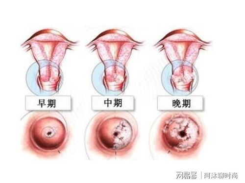 �����Ų�31�����Ų���ѹۿ�