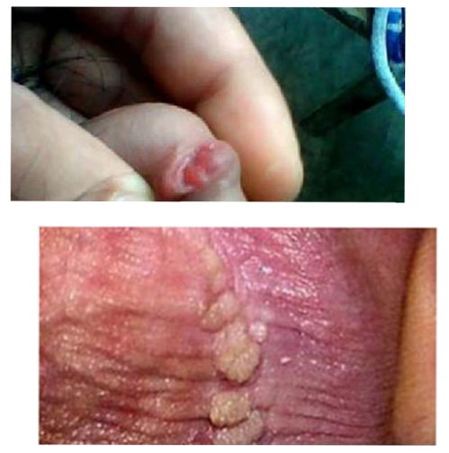 �������谩֢ ���ȸ�ĸ