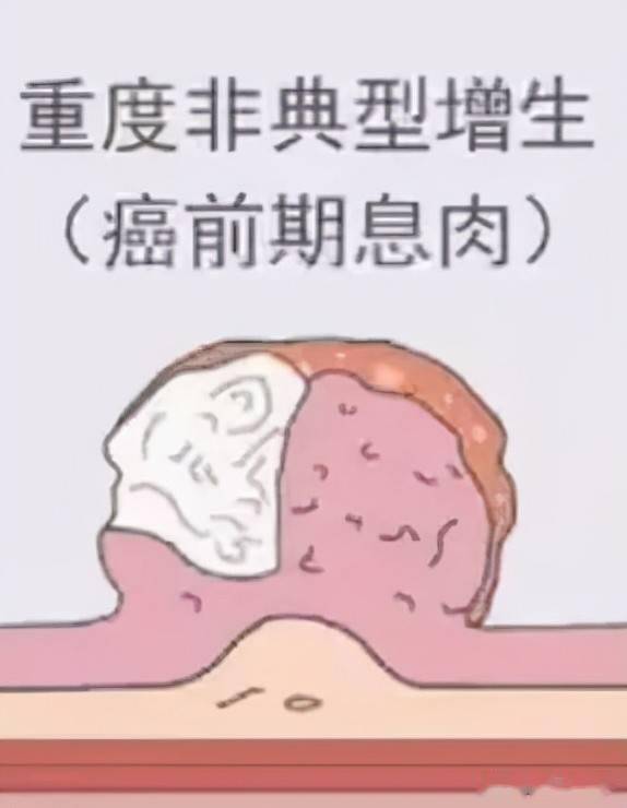 �߹��۰�֢�߹��� ��֢