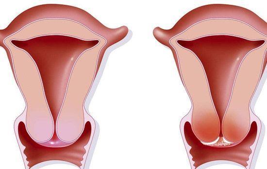 糖尿病中风是癌症吗(糖尿病中风是癌症吗能治好吗) 糖尿病中风是癌症吗(糖尿病中风是癌症吗能治好吗)
