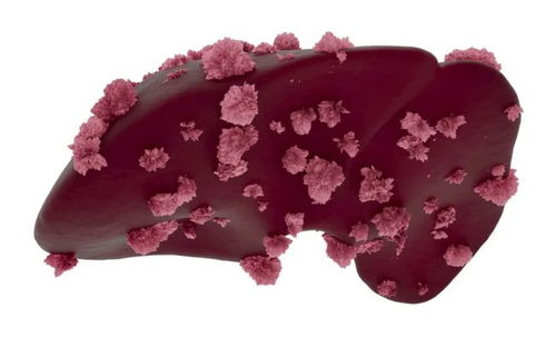 ��ֻ֢���� ��֢������