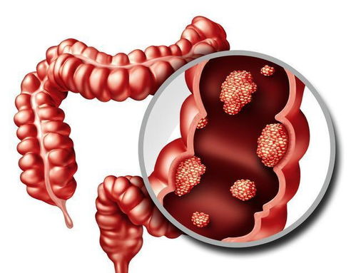 庄河妇科癌症 庄河妇产医院能做人流吗 庄河妇科癌症 庄河妇产医院能做人流吗