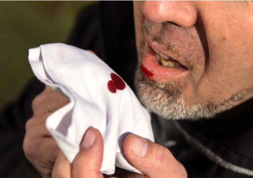 癌症硬块变小(癌症 硬块) 癌症硬块变小(癌症 硬块)