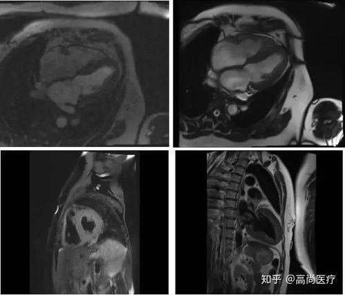 深圳癌症群 深圳癌症康复协会地址 深圳癌症群 深圳癌症康复协会地址