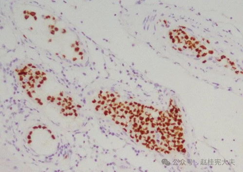 ������֢Ů�� ��֢Ů��Ϊ�Ϲ���Ů����