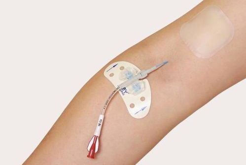 经常肚子饿是癌症什么期 经常肚子饿是癌症什么期