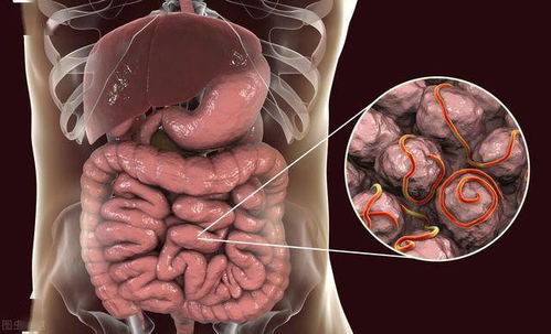 92�갩֢�������ʽ