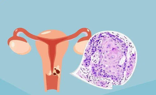 耳朵后面生癌症概率大吗 耳朵后面生癌症概率大吗