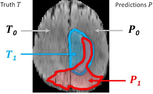 �����ɻ�Ӧ��֢ ���������