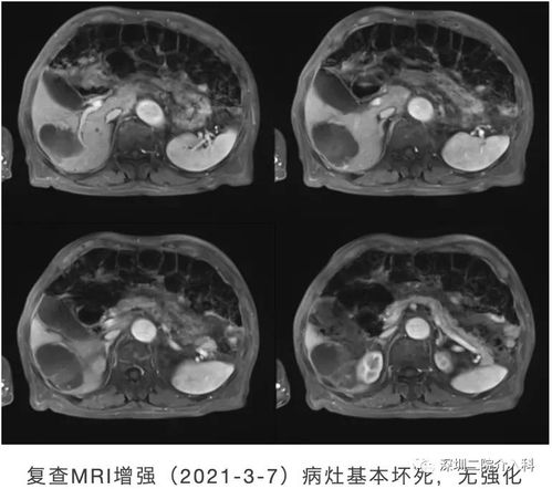 ��֢���˻����ܲ�������