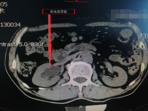 ���ϰ�֢����Ͷ������