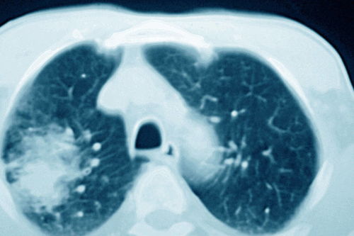 ��఩֢�ط� ��఩֢�ط����а�