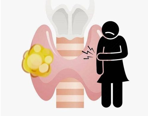 ���Ϲ��ð�֢ ƭ�Ϲ��Լ����˰�֢