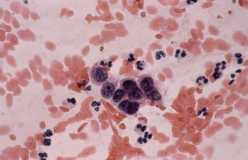 �˷��ְ�֢ ���˿ְ�֢��ô����