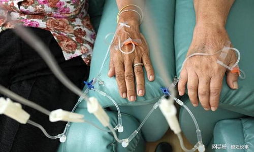 Ů������֢���(Ů������֢������ô��)