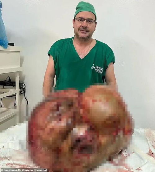 针灸治疗癌症厌食怎么办 针灸治疗癌症厌食怎么办