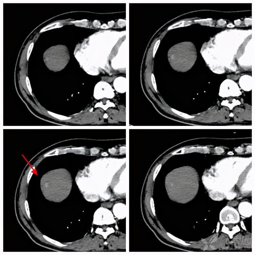 �������ư�֢ �����ѿ����ΰ���