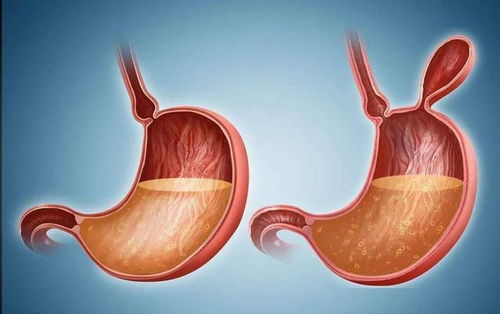 安徽癌症患者男女比例 安徽癌症患者男女比例