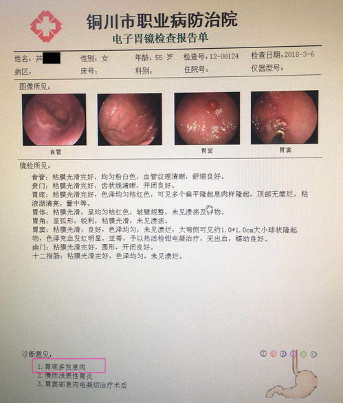 ���ڸ߷��İ�֢����Щ