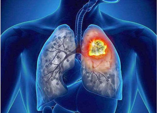 国外明星偷税漏税案例 国外明星偷税漏税案例