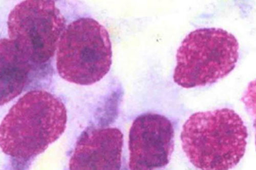 大便常规能检查癌症吗 大便常规能检查癌症吗