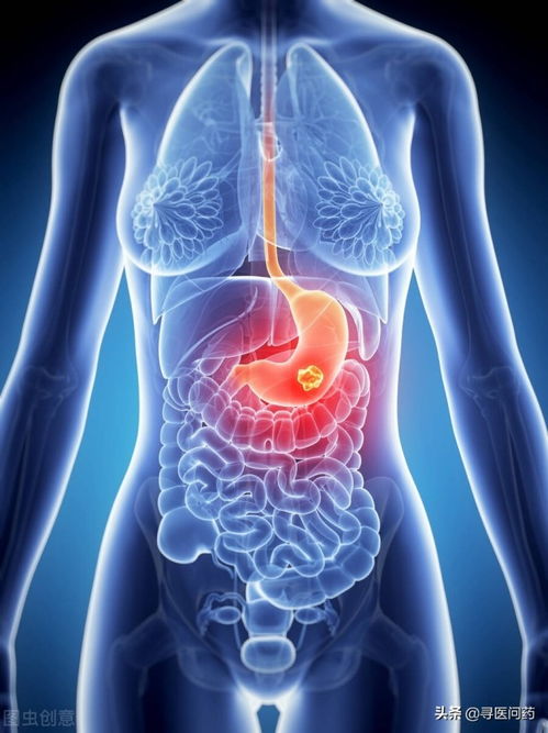 宫锁连城电视剧免费看 宫锁连城电视剧免费看