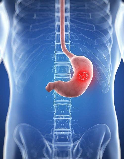 癌症母亲舅舅(癌症母亲舅舅能活多久) 癌症母亲舅舅(癌症母亲舅舅能活多久)