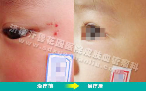 疯狂老奶奶 疯狂老奶奶跑酷下载 疯狂老奶奶 疯狂老奶奶跑酷下载