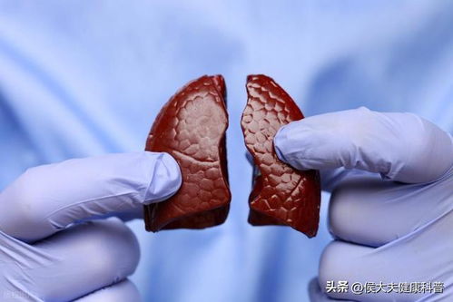 Ŀǰ��֢���ж����ְ�֢