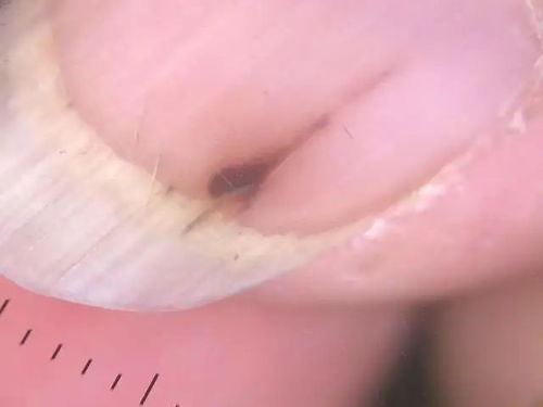 ��֢�ε��� �ΰ����ߵ��׵��Ƿ��������� 