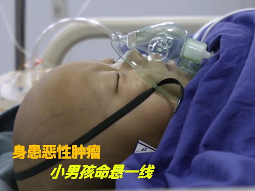 转移的癌症免疫组化表达 转移的癌症免疫组化表达