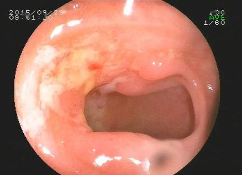 ��֢һ���ۼ��겻����