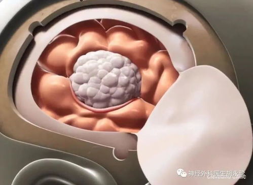 ����ʹ�����ǰ�֢ת����