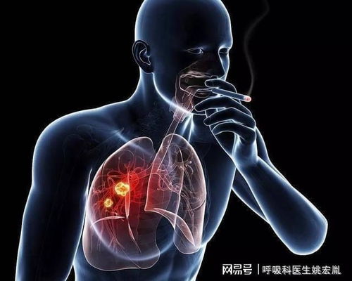 �����İ�֢�Ʒ� ���ְ�֢���Ʒ���