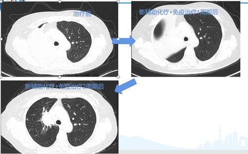 吃一次烧烤会不会得癌症 吃一次烧烤会不会得癌症