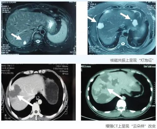 ��Ա�����ͽ�������״