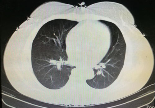 ���崯�Ͱ�֢ ���崯�ϲ������ļ���