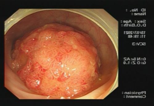 �鷿�����᲻���ɰ�֢