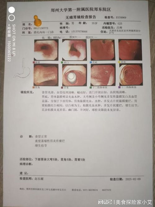 农村医生谈癌症治疗 农村人患癌症有补偿吗 农村医生谈癌症治疗 农村人患癌症有补偿吗