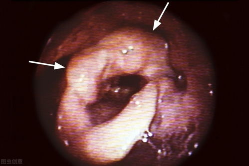 ��֢�������ϳ�����ô