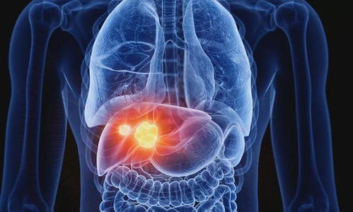 ����һ��֢_�����ǲ���