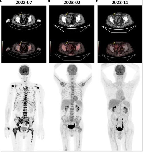 ��״��һ���״��ǰ�֢��