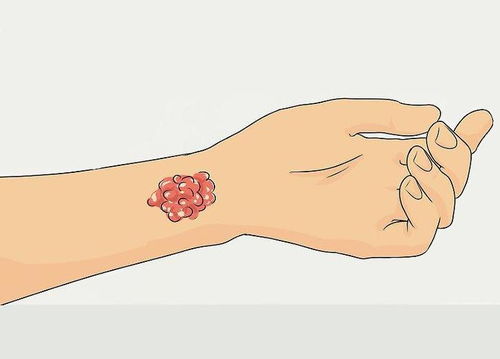 �β�û�������ǰ�֢��