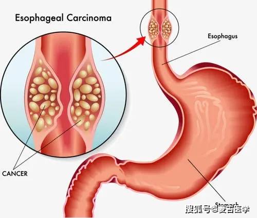 ʲôʳƷ֢ ʲôʳƷ֢ս50%