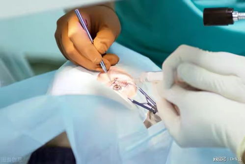 �����𽥱����ǰ�֢��