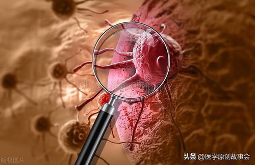 落叶生根癌症 落叶生根有什么药用 落叶生根癌症 落叶生根有什么药用