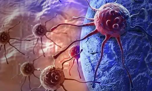 老年人肺长肿瘤是癌症吗 老年人肺长肿瘤是癌症吗